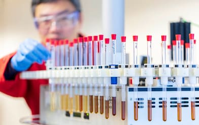 What Oil Analysis Reveals About Your Engine and Oil